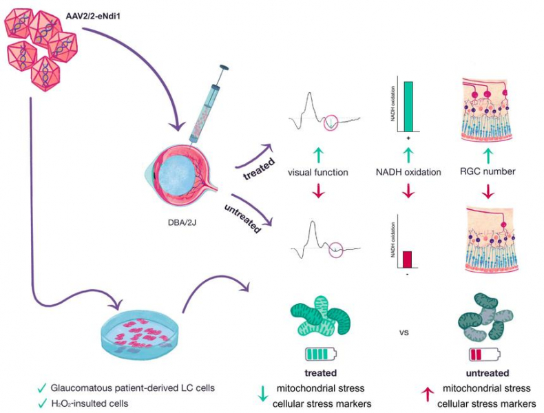 Ученые разработали новую генную терапию для лечения глаукомы